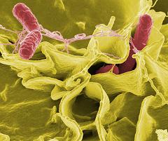 salmonella invading cultured human cells