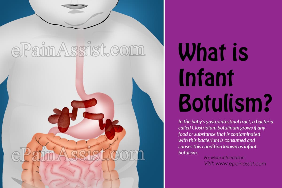 how common is infant botulism and what causes botulism in young kids