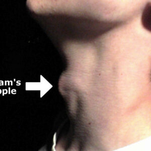 how did the adams apple get its name and where does the term adams apple come from