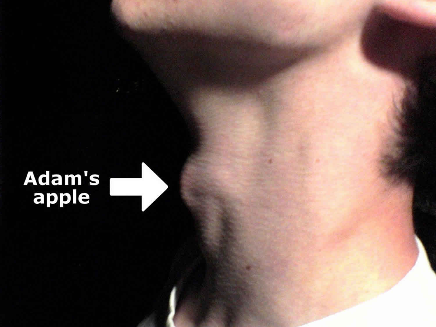 how did the adams apple get its name and where does the term adams apple come from