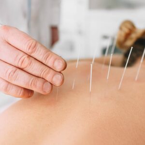 how do chinese physicians treat drug addiction with acupuncture detoxification