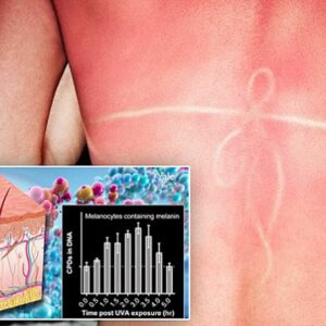 how does ultraviolet radiation cause skin cancer