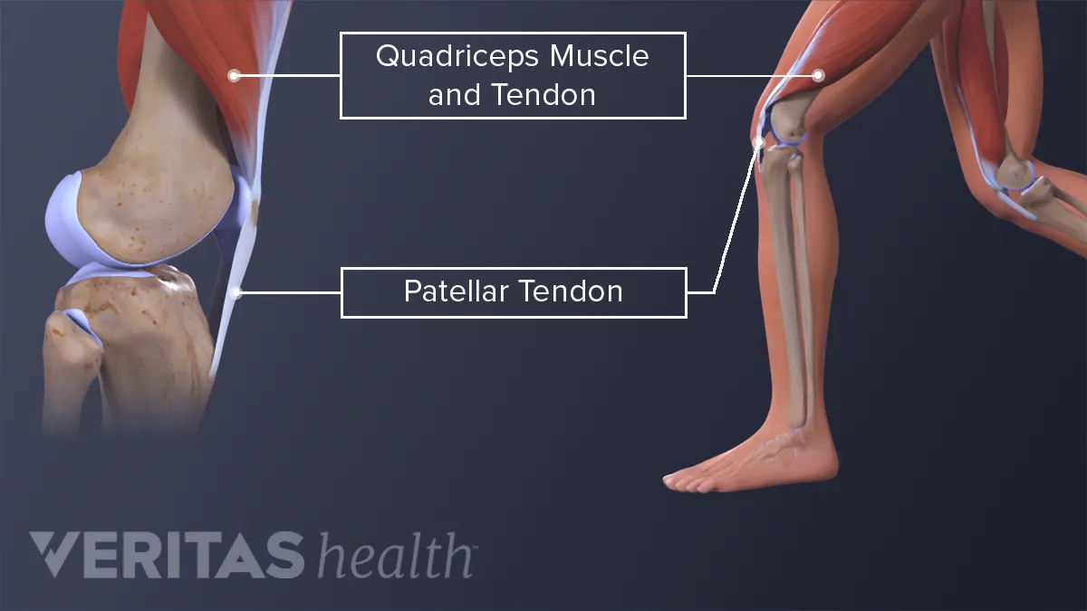 what causes sore muscles stiffness aches and pains the day after prolonged running or exercise