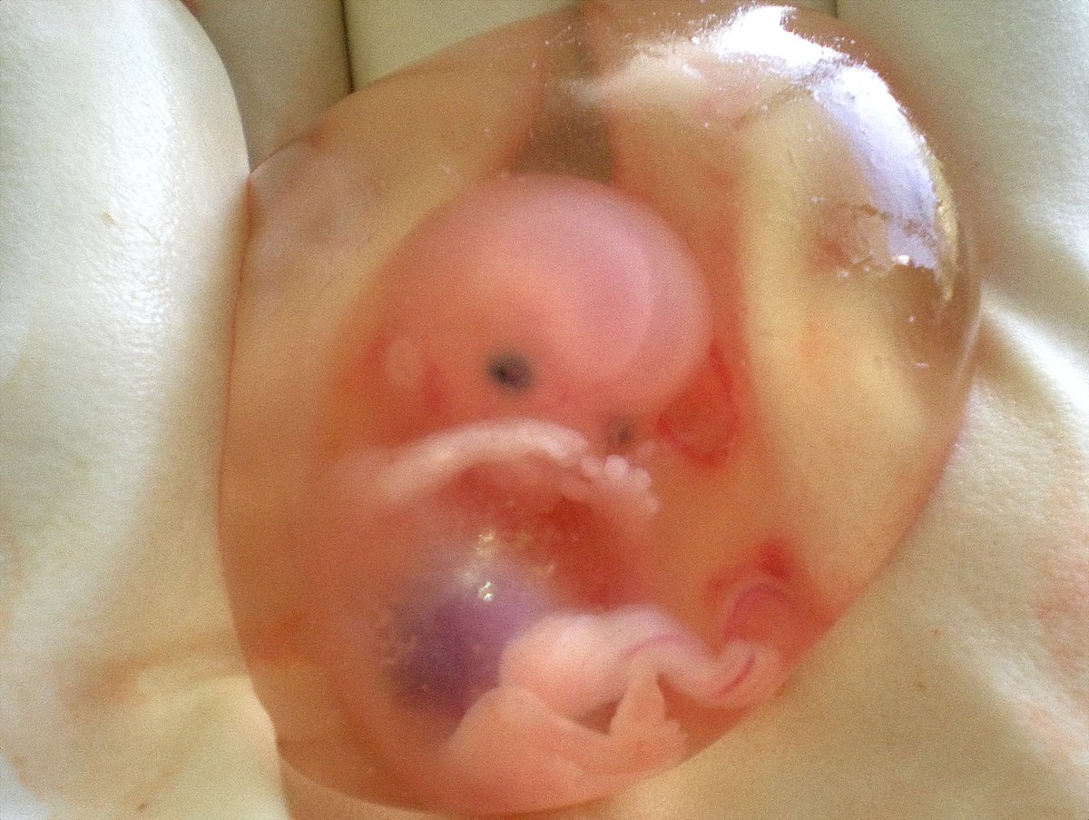 what is amniotic fluid made of and where does it come from