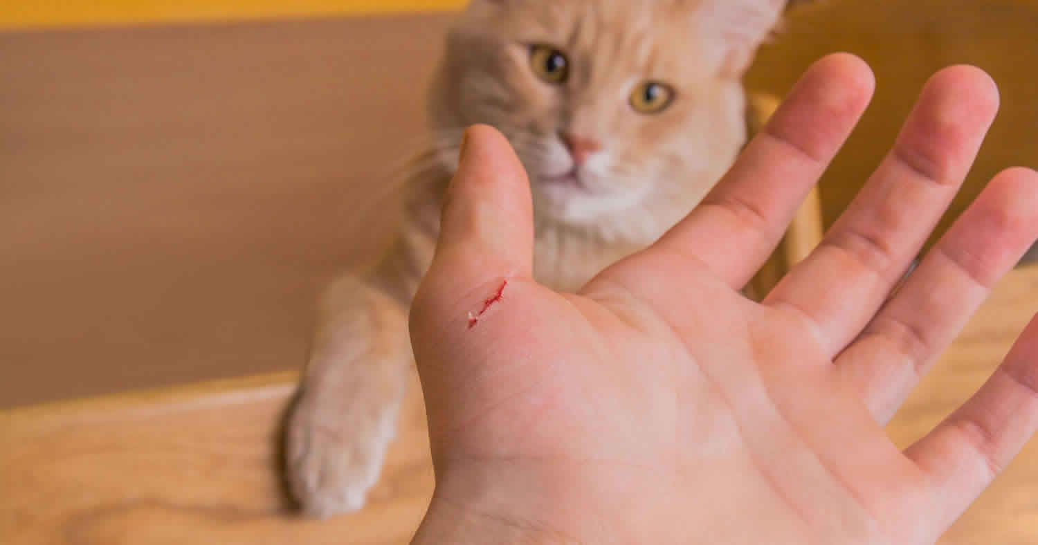 where did cat scratch disease come from and what is the best way to prevent cat scratch disease