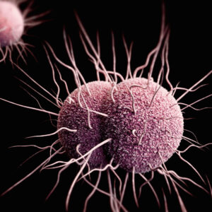 where did gonorrhea come from and how is a gonorrhea infection treated