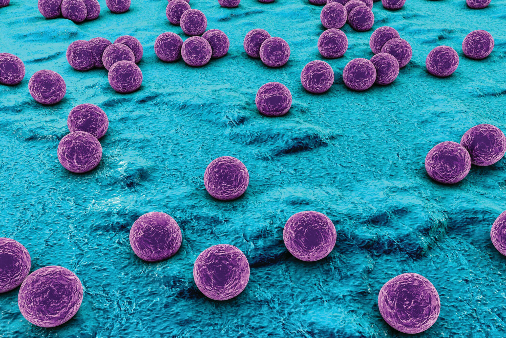 where does s aureus bacteria come from and how is s aureus food poisoning prevented scaled